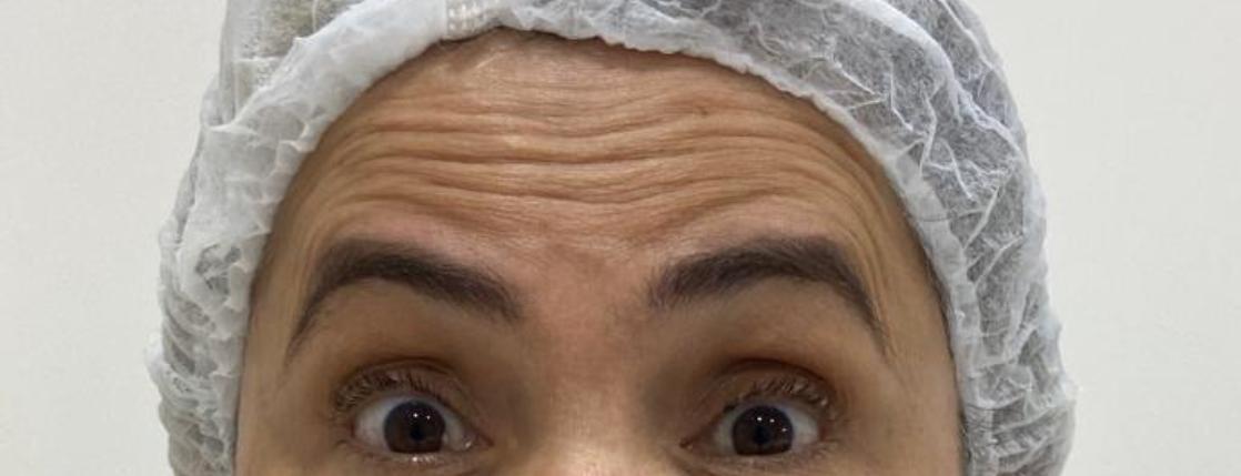 Antes do procedimento — Caso 1