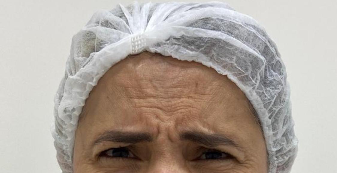 Antes do procedimento — Caso 2