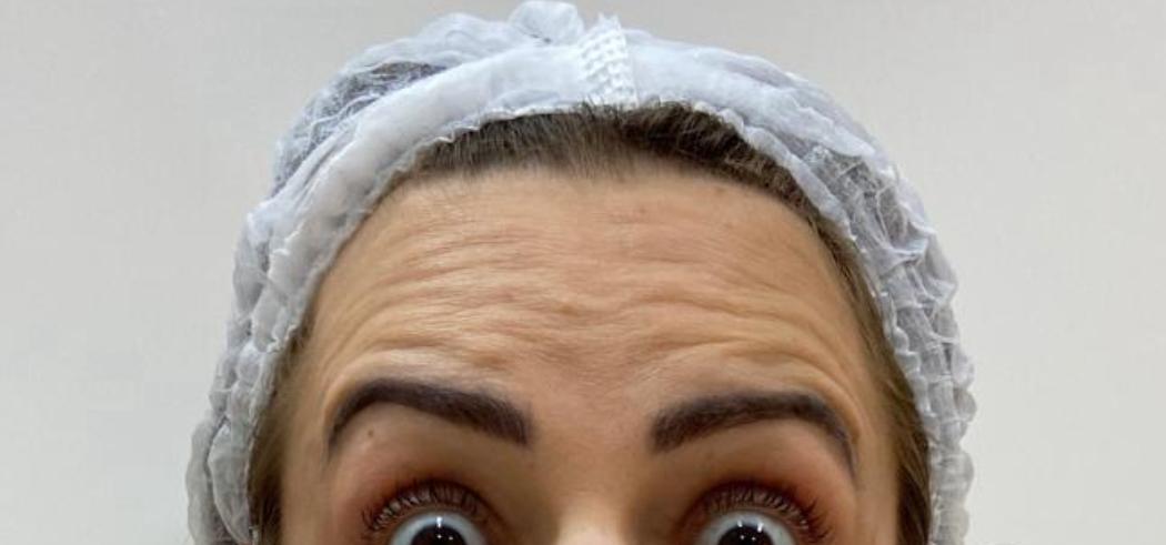 Antes do procedimento — Caso 3